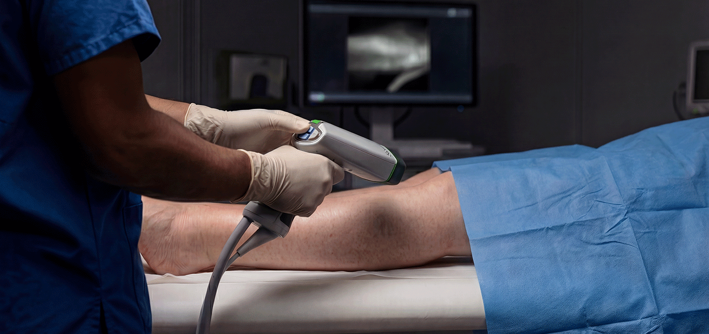 A consultant surgeon performing real-time Indocyanine Green (ICG) lymphography on a patient's lower limb using a handheld near-infrared (NIR) fluorescence camera, with a monitor displaying lymphatic flow patterns.