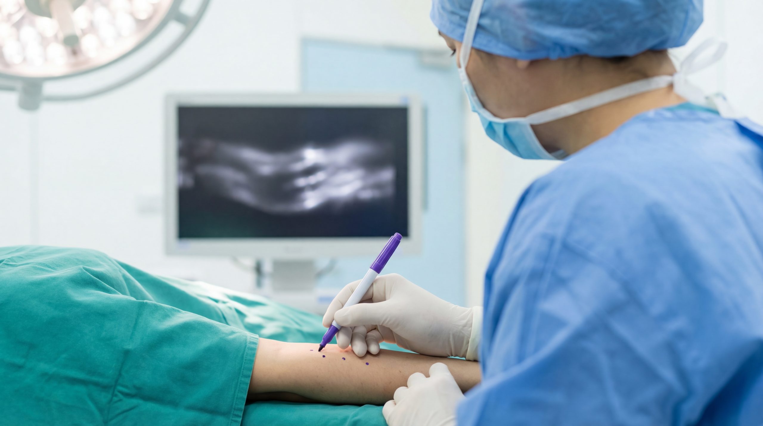 A surgeon in the operating theatre marks a patient's arm with a surgical pen. In the background, a high-definition monitor displays a real-time ICG (Indocyanine Green) fluorescence scan, showing the functional lymphatic vessels as glowing green pathways. This technological roadmap allows for precise, minimally invasive incisions during the surgical journey.